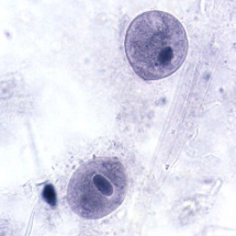 Balantidium coli