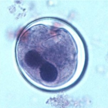 Balantidium coli-cisti