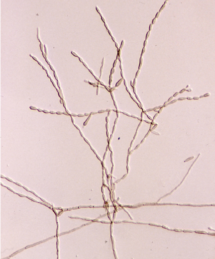 Cladophialophora bantiana