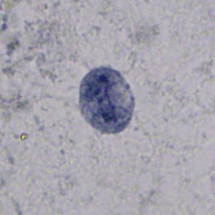 Dientamoeba fragilis1