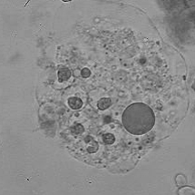 Cellula con inclusioni citoplasmatiche