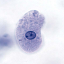 Entamoeba histolytica1