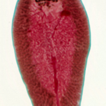 Fasciola epatica1