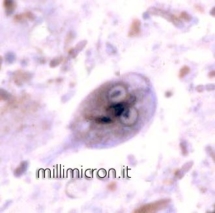 Giardia lamblia - Trofozoite -