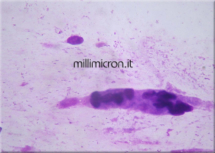 Helicobacter pylori2