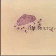 Leishmania4