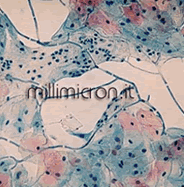 Monilia candida1