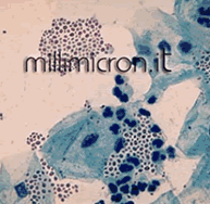 Monilia candida2