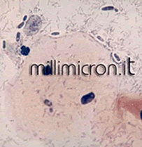 Monilia candida3