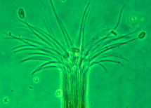 Ophiostoma novo-ulmi