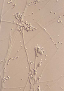 Paecilomyces lilacinus