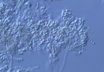 Penicillium marneffei