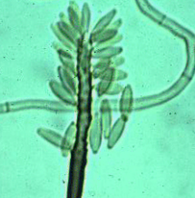 Rhinocladiella aquaspersa-1