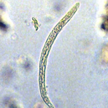 Strongyloides stercoralis - Larva -