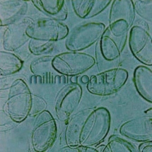Uova di Enterobius vermicularis