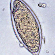 Uova diSchistosoma haematobium