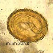 Uovo di Ascaris lumbricoides con larva