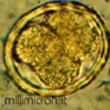 Uovo di Ascaris lumbricoides1