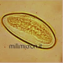 Uovo di Enterobius vermicularis1